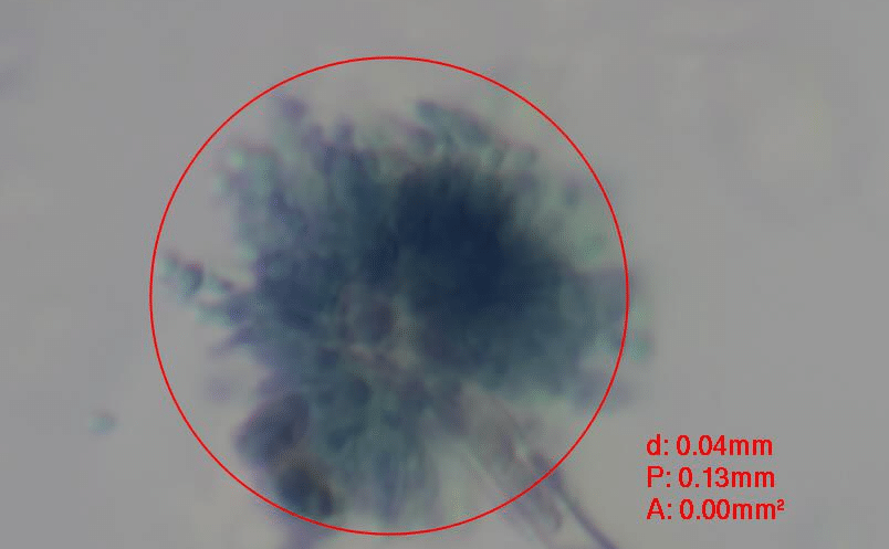 Schimmelpilz Aspergillus unter dem Mikroskop