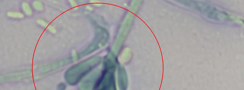 Schimmel unter dem Mikroskop – Stachybotrys spp. aus unserer Erstuntersuchung